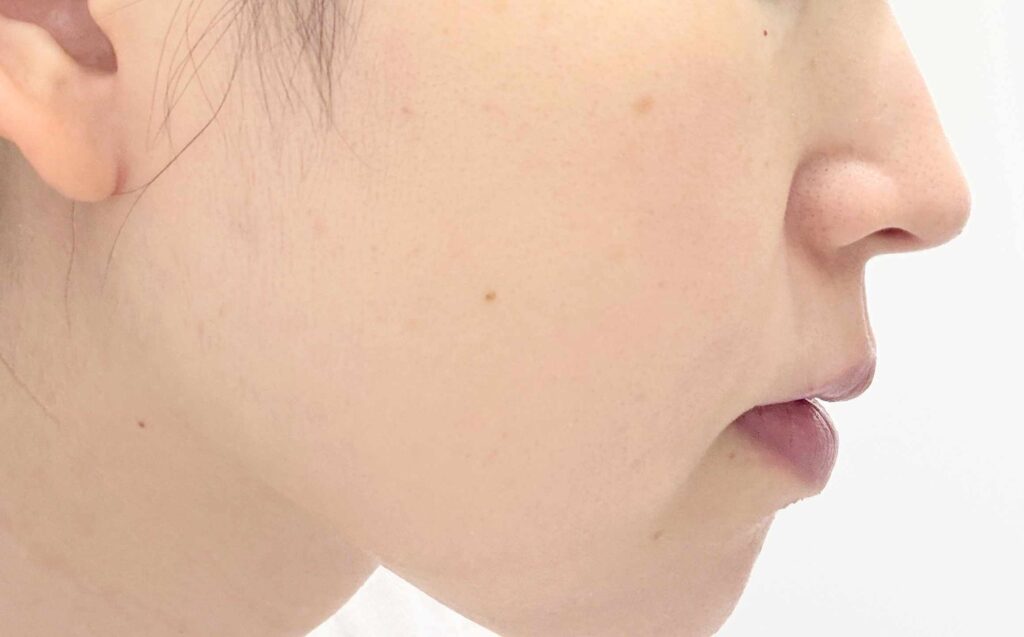 PARTIE　コンプリートセラムローション　化粧液　敏感肌